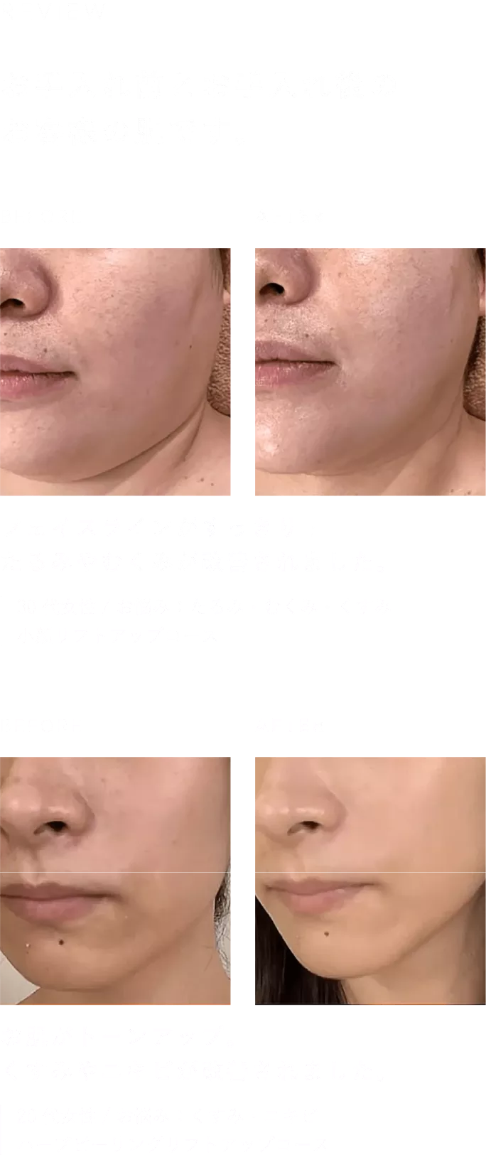 ビフォーアフター